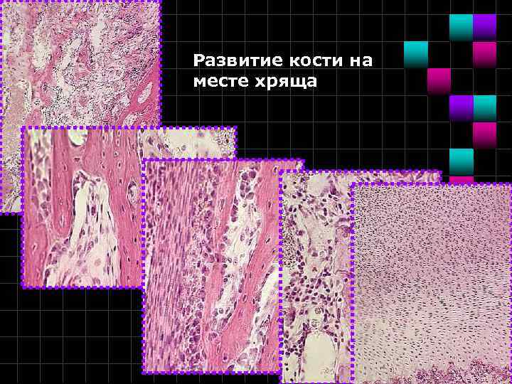 Развитие кости на месте хряща 