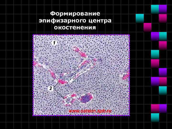 Формирование эпифизарного центра окостенения 