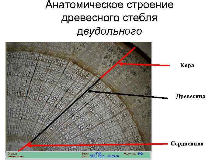 Анатомическое строение древесного стебля двудольного Кора Древесина Сердцевина 