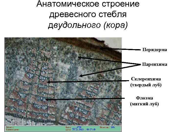 Анатомическое строение древесного стебля двудольного (кора) Перидерма Паренхима Склеренхима (твердый луб) Флоэма (мягкий луб)