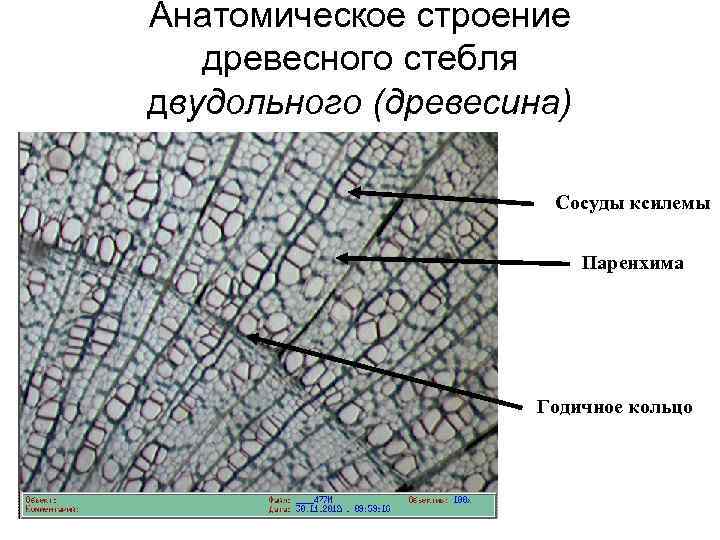 Анатомическое строение древесного стебля двудольного (древесина) Сосуды ксилемы Паренхима Годичное кольцо 