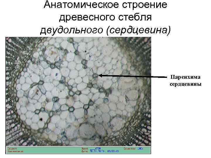 Анатомическое строение древесного стебля двудольного (сердцевина) Паренхима сердцевины 