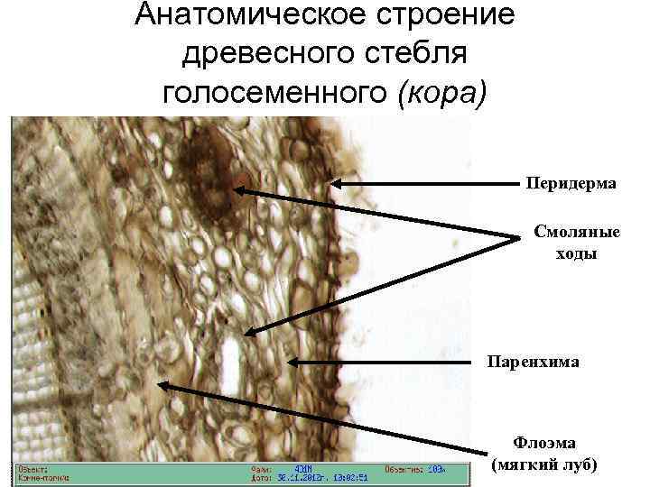 Анатомическое строение древесного стебля голосеменного (кора) Перидерма Смоляные ходы Паренхима Флоэма (мягкий луб) 