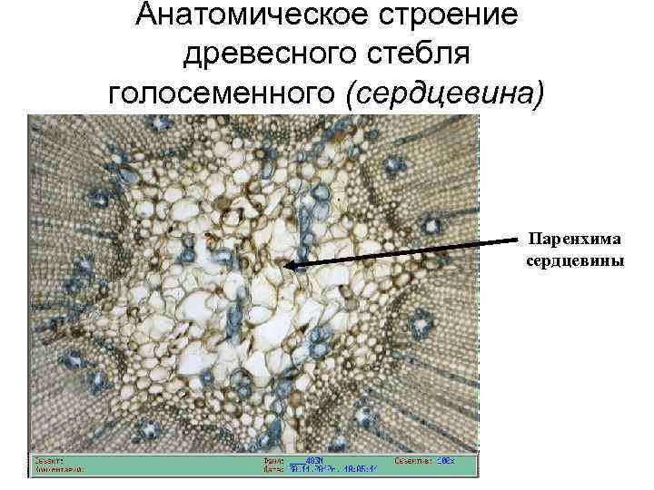 Анатомическое строение древесного стебля голосеменного (сердцевина) Паренхима сердцевины 