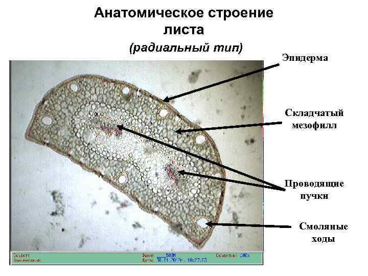 Анатомическое строение листа (радиальный тип) Эпидерма Складчатый мезофилл Проводящие пучки Смоляные ходы 