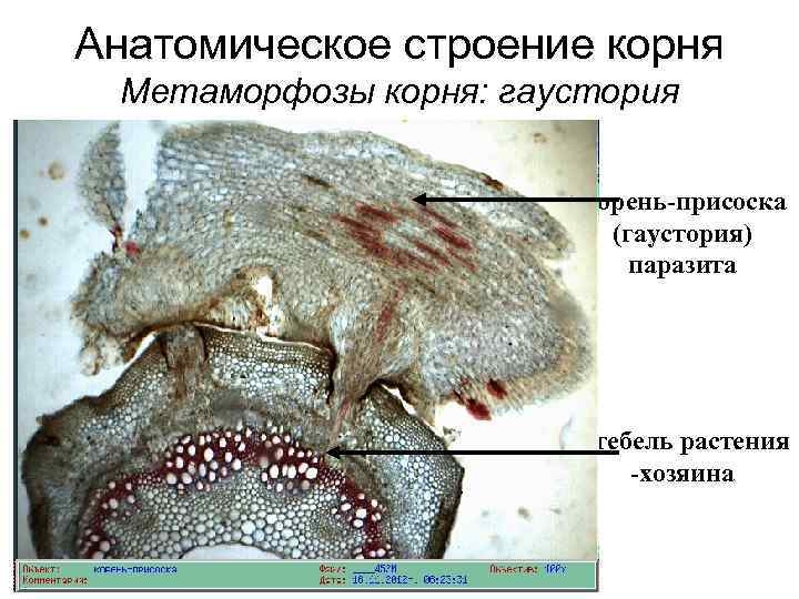 Анатомическое строение корня Метаморфозы корня: гаустория Корень-присоска (гаустория) паразита Стебель растения -хозяина 