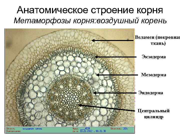 Цилиндр корень. Поперечный срез корня орхидных. Воздушный корень орхидных поперечный срез. Строение корня орхидеи. Поперечный срез воздушного корня орхидеи.