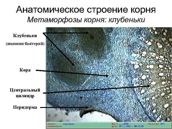 Анатомическое строение корня Метаморфозы корня: клубеньки Клубеньки (колонии бактерий) Кора Центральный цилиндр Перидерма 