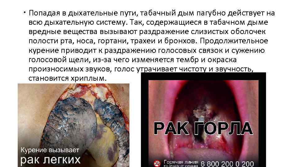  Попадая в дыхательные пути, табачный дым пагубно действует на всю дыхательную систему. Так,