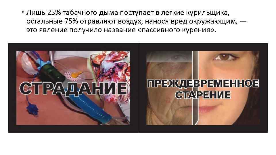  Лишь 25% табачного дыма поступает в легкие курильщика, остальные 75% отравляют воздух, нанося