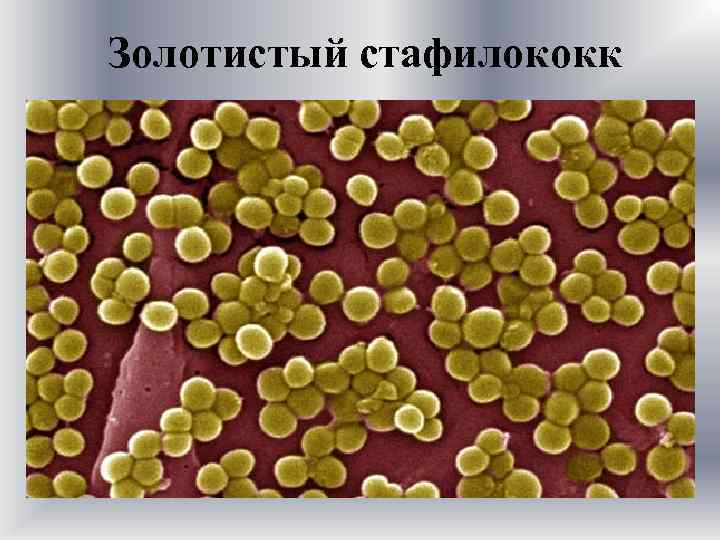 Золотистый стафилококк 