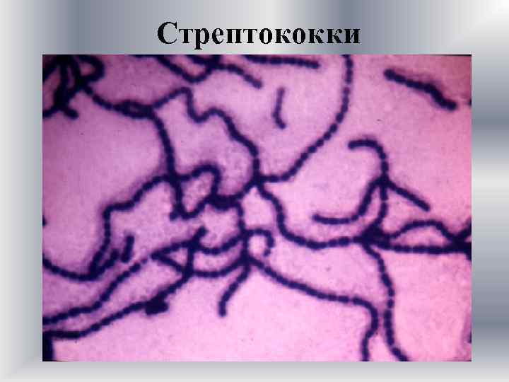 Стрептококки 