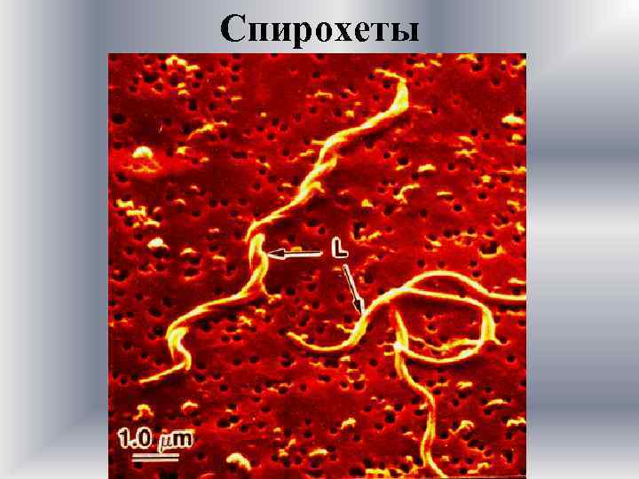 Спирохеты 