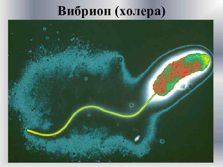 Вибрион (холера) 