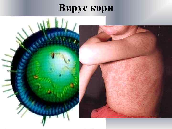 Вирус кори 