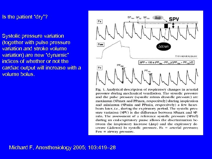 Is the patient “dry”? Systolic pressure variation (together with pulse pressure variation and stroke