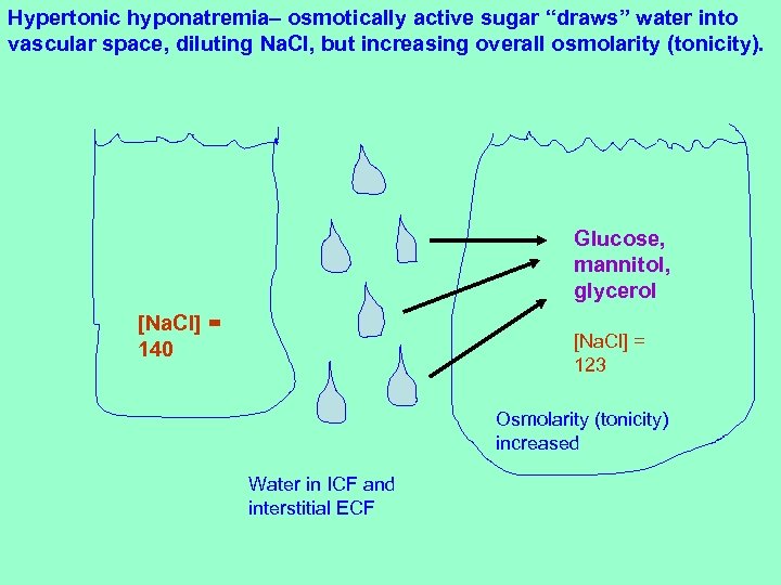 Hypertonic hyponatremia– osmotically active sugar “draws” water into vascular space, diluting Na. Cl, but