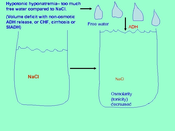 Hypotonic hyponatremia– too much free water compared to Na. Cl. (Volume deficit with non-osmotic