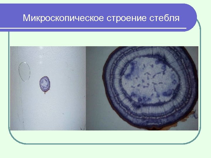 Микроскопическое строение стебля 