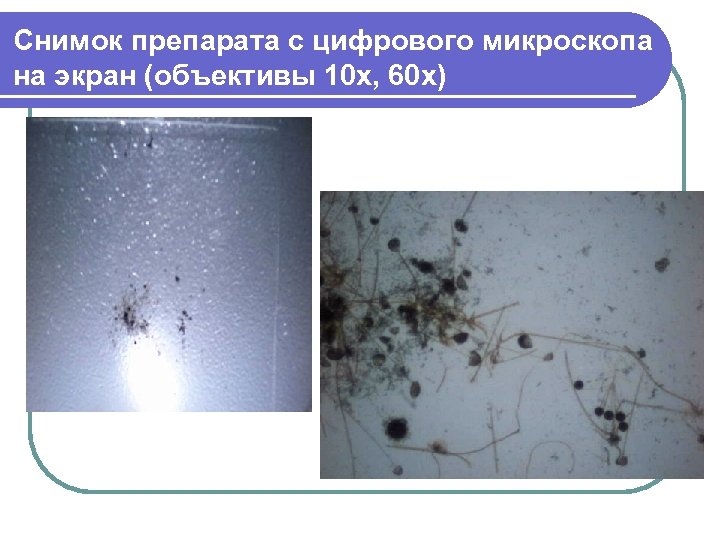 Снимок препарата с цифрового микроскопа на экран (объективы 10 х, 60 х) 