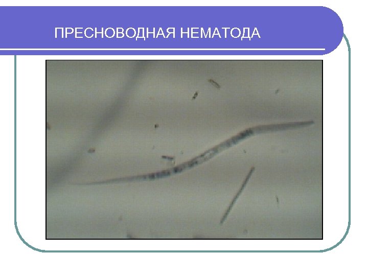 ПРЕСНОВОДНАЯ НЕМАТОДА 