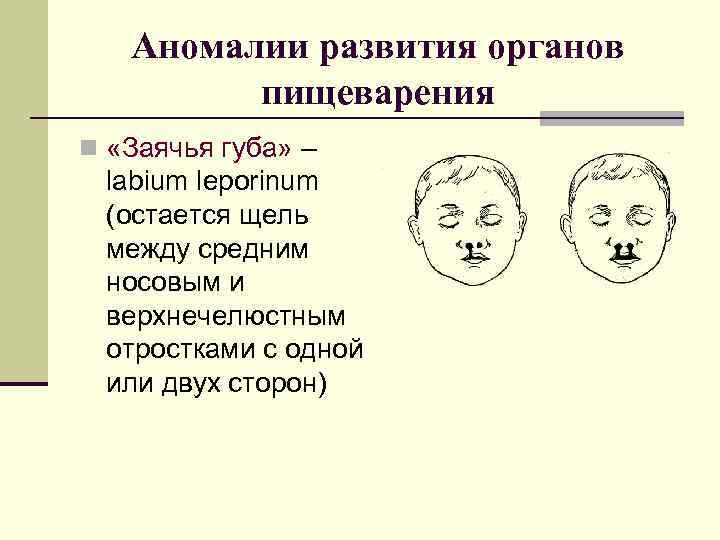 Аномалии развития органов пищеварения n «Заячья губа» – labium leporinum (остается щель между средним