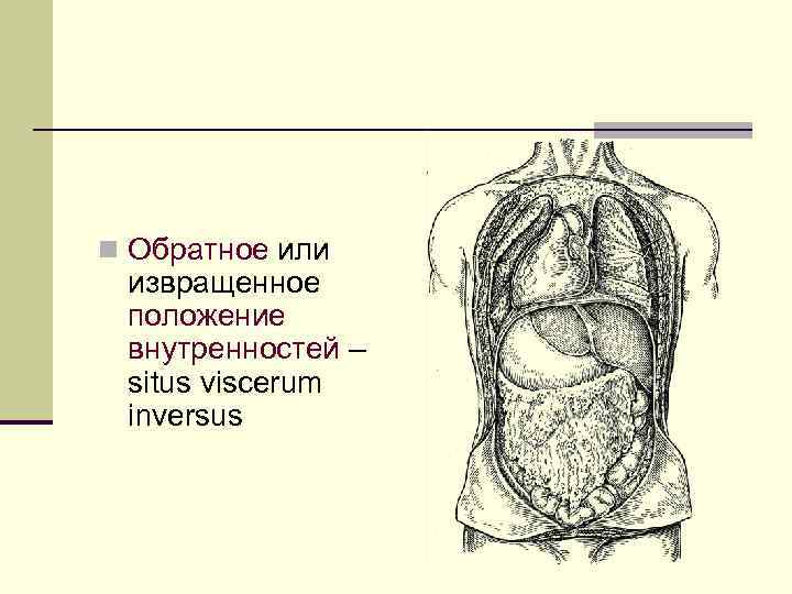 n Обратное или извращенное положение внутренностей – situs viscerum inversus 