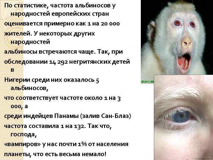 По статистике, частота альбиносов у народностей европейских стран оценивается примерно как 1 на 20