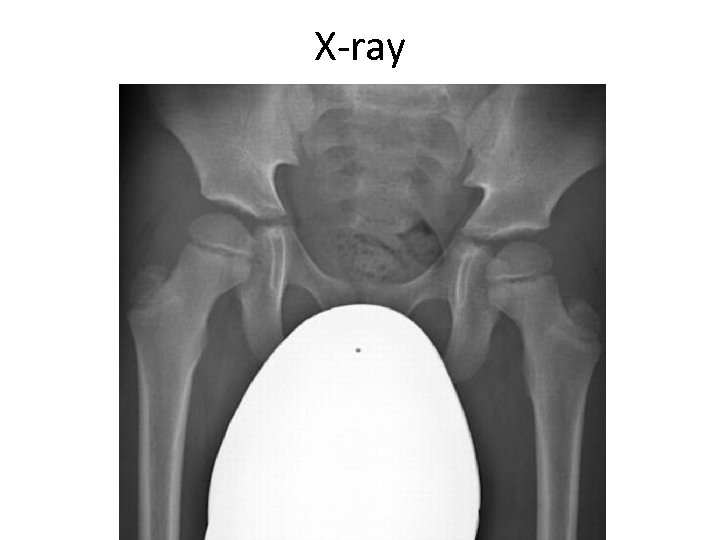 X-ray 