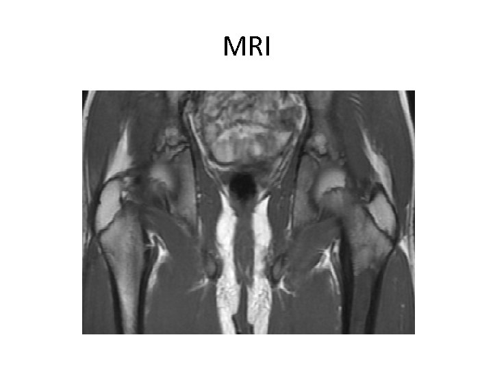MRI 