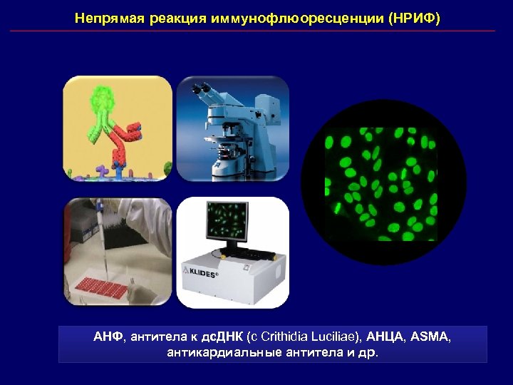 Непрямая реакция иммунофлюоресценции (НРИФ) АНФ, антитела к дс. ДНК (с Crithidia Luciliae), АНЦА, ASMA,