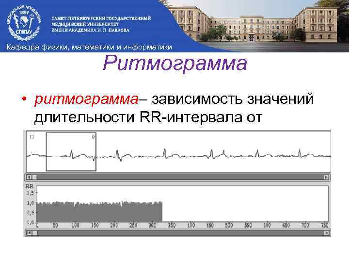 Кафедра физики, математики и информатики Ритмограмма • ритмограмма– зависимость значений длительности RR-интервала от порядкового