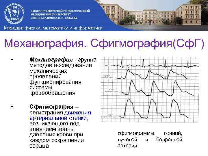 Кафедра физики, математики и информатики Механография. Сфигмография(Сф. Г) • Механография - группа методов исследования