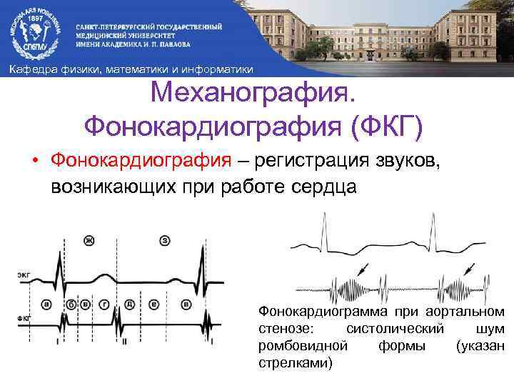 Кафедра физики, математики и информатики Механография. Фонокардиография (ФКГ) • Фонокардиография – регистрация звуков, возникающих