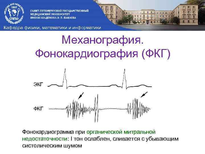 Кафедра физики, математики и информатики Механография. Фонокардиография (ФКГ) ЭКГ Фонокардиограмма при органической митральной недостаточности: