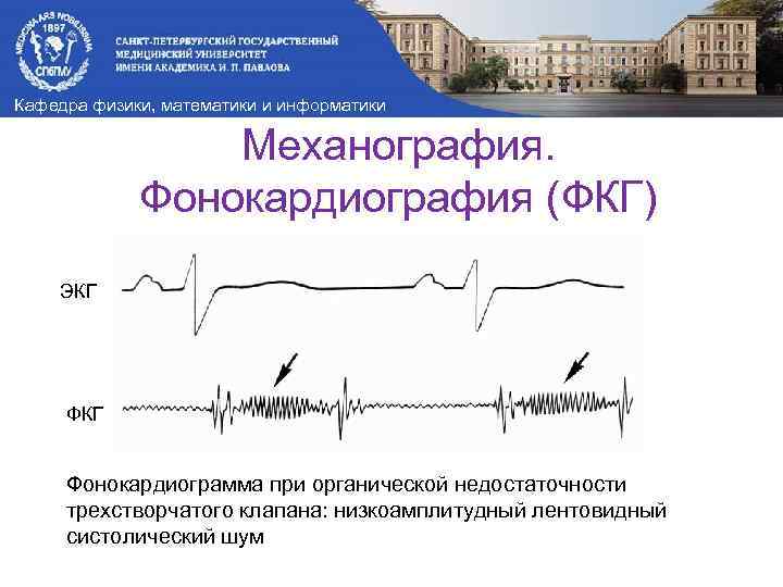 Кафедра физики, математики и информатики Механография. Фонокардиография (ФКГ) ЭКГ Фонокардиограмма при органической недостаточности трехстворчатого