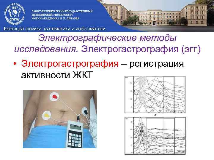 Кафедра физики, математики и информатики Электрографические методы исследования. Электрогастрография (ЭГГ) • Электрогастрография – регистрация