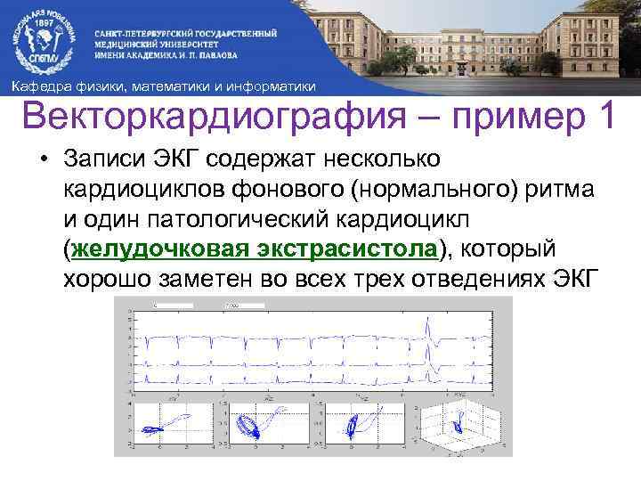 Кафедра физики, математики и информатики Векторкардиография – пример 1 • Записи ЭКГ содержат несколько