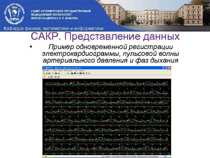 Кафедра физики, математики и информатики САКР. Представление данных • Пример одновременной регистрации электрокардиограммы, пульсовой