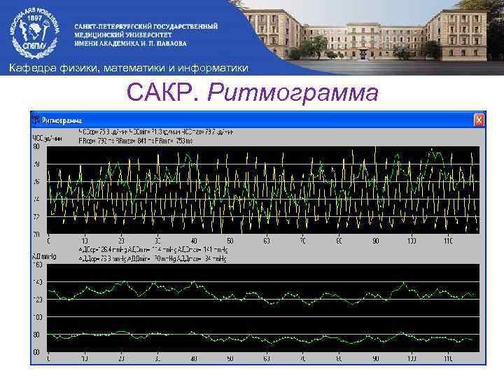 Кафедра физики, математики и информатики САКР. Ритмограмма 