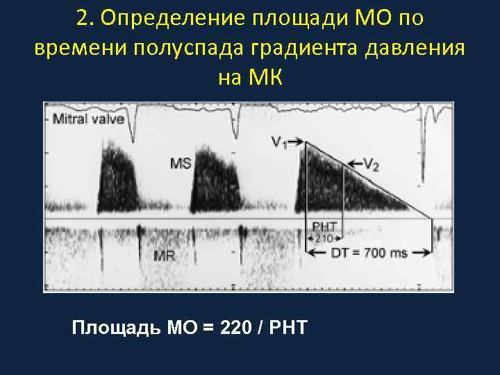 2. Определение площади МО по времени полуспада градиента давления на МК Площадь МО =