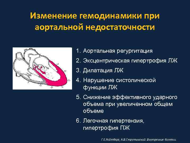 Изменение гемодинамики при аортальной недостаточности 1. Аортальная регургитация 2. Эксцентрическая гипертрофия ЛЖ 3. Дилатация