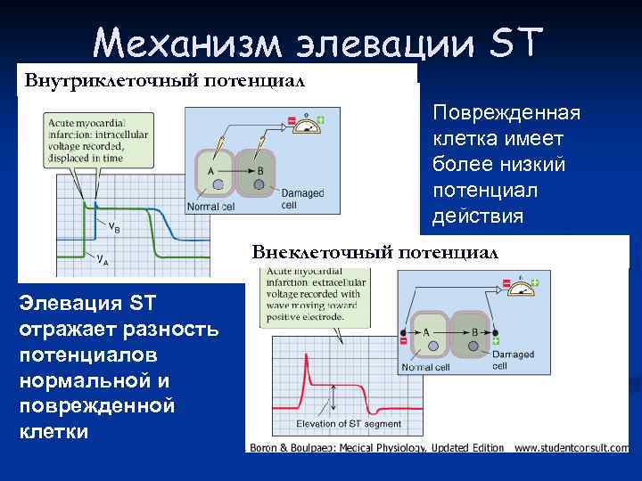 Механизм элевации ST Внутриклеточный потенциал Поврежденная клетка имеет более низкий потенциал действия Внеклеточный потенциал