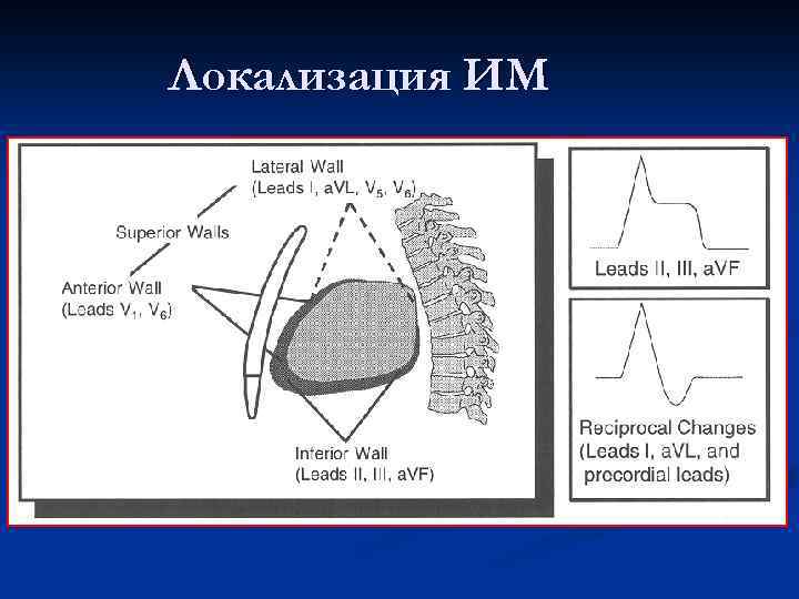 Локализация ИМ 