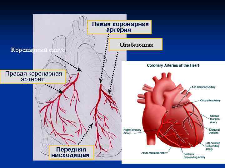 Левая коронарная артерия Коронарный синус Правая коронарная артерия Передняя нисходящая Огибающая 