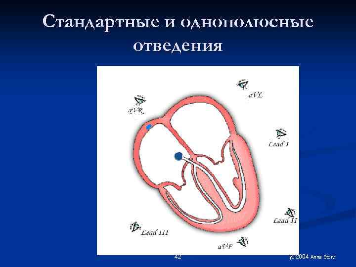 Стандартные и однополюсные отведения 42 2004 Anna Story 