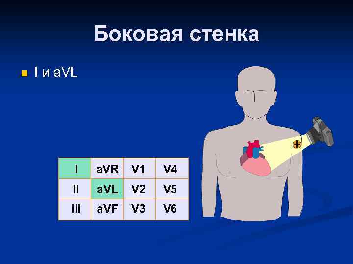 Боковая стенка n I и a. VL I a. VR V 1 V 4