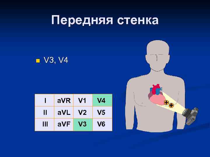 Передняя стенка n V 3, V 4 I a. VR V 1 V 4