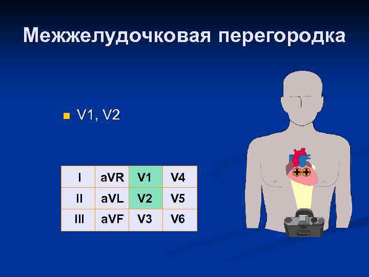 Межжелудочковая перегородка n V 1, V 2 I a. VR V 1 V 4