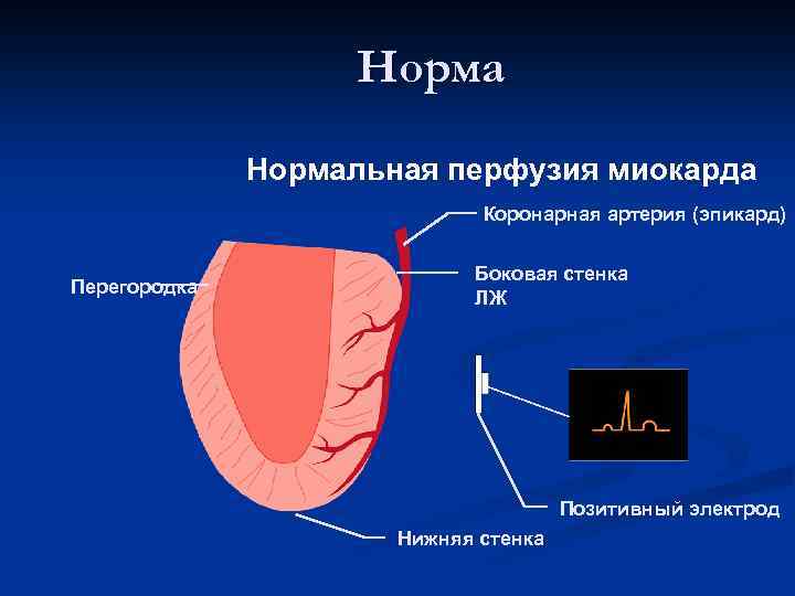 Эпикард топливная карта